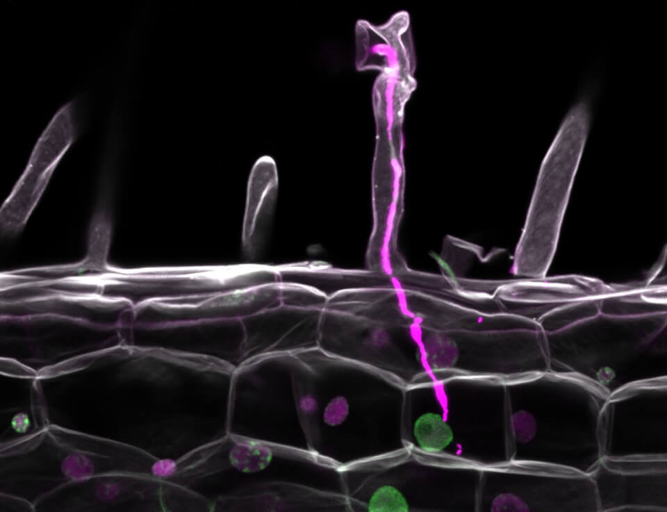 Microscopy image of a legume root inoculated with nitrogen-fixing bacteria that has formed an infection thread