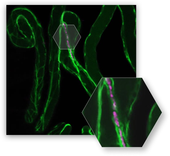 Nitrogen Fixation and Bacterial Infection