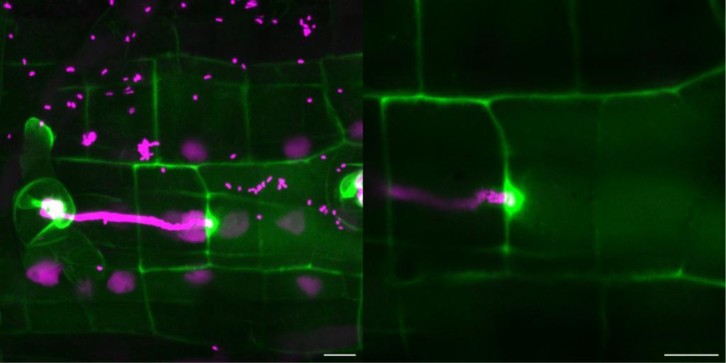 Live-cell confocal microscopy image of subcellular localization of LjEXPA1 during intracellular rhizobial infection at the transcellular passage cleft. Image: Beatrice Lace, University of Freiburg.