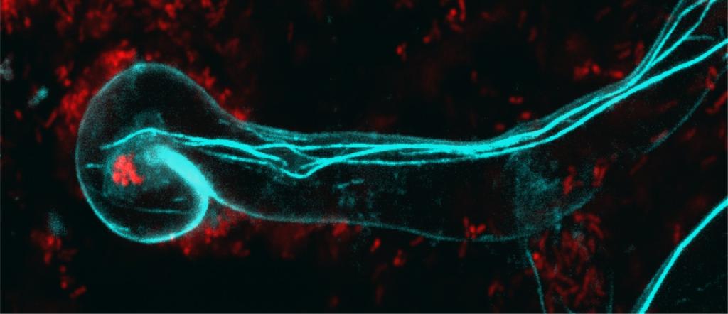 Adapted from Qiao L. & Sun H. Et al. Science, 2026. Live-cell confocal microscopy image of the tip of a root hair cell showing internal structural filaments (blue) and infecting bacteria (red). When SYFO2 was removed, these structural filaments could not be seen.