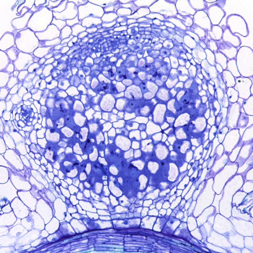 Microscope image of toluidine blue-stained nodule section from the nodulating legume Medicago truncatula, induced by a single amino acid modified NIN from the non-nodulating plant Arabidopsis.